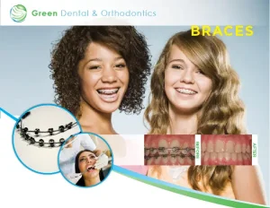 Treatment for Kids - Clear Smiles Orthodontics