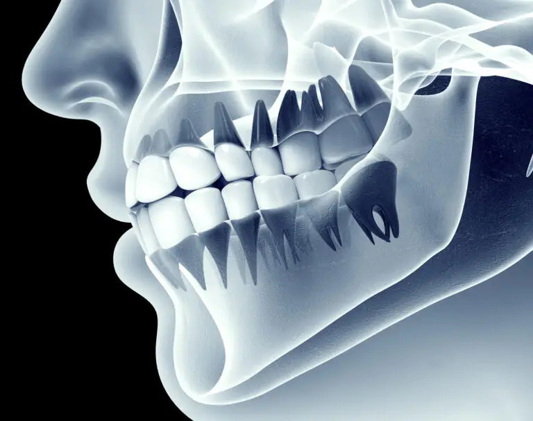 Sherman Oaks Digital Dental X-ray