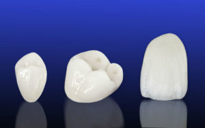 What’s Involved Getting Porcelain Crowns