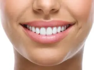 Porcelain Veneers