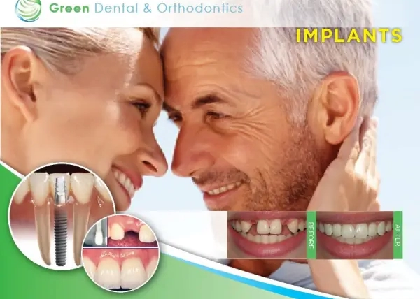 What is involved with dental implants