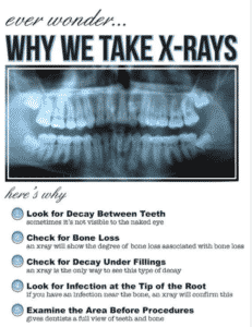 Sherman Oaks Digital Dental X-ray