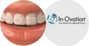 In-Ovation L MTM, Orthodontist San Diego