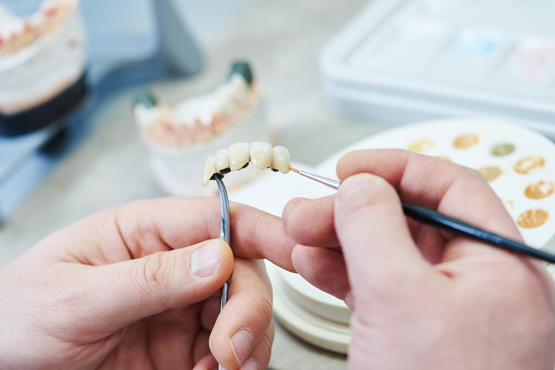 Dental Restoration