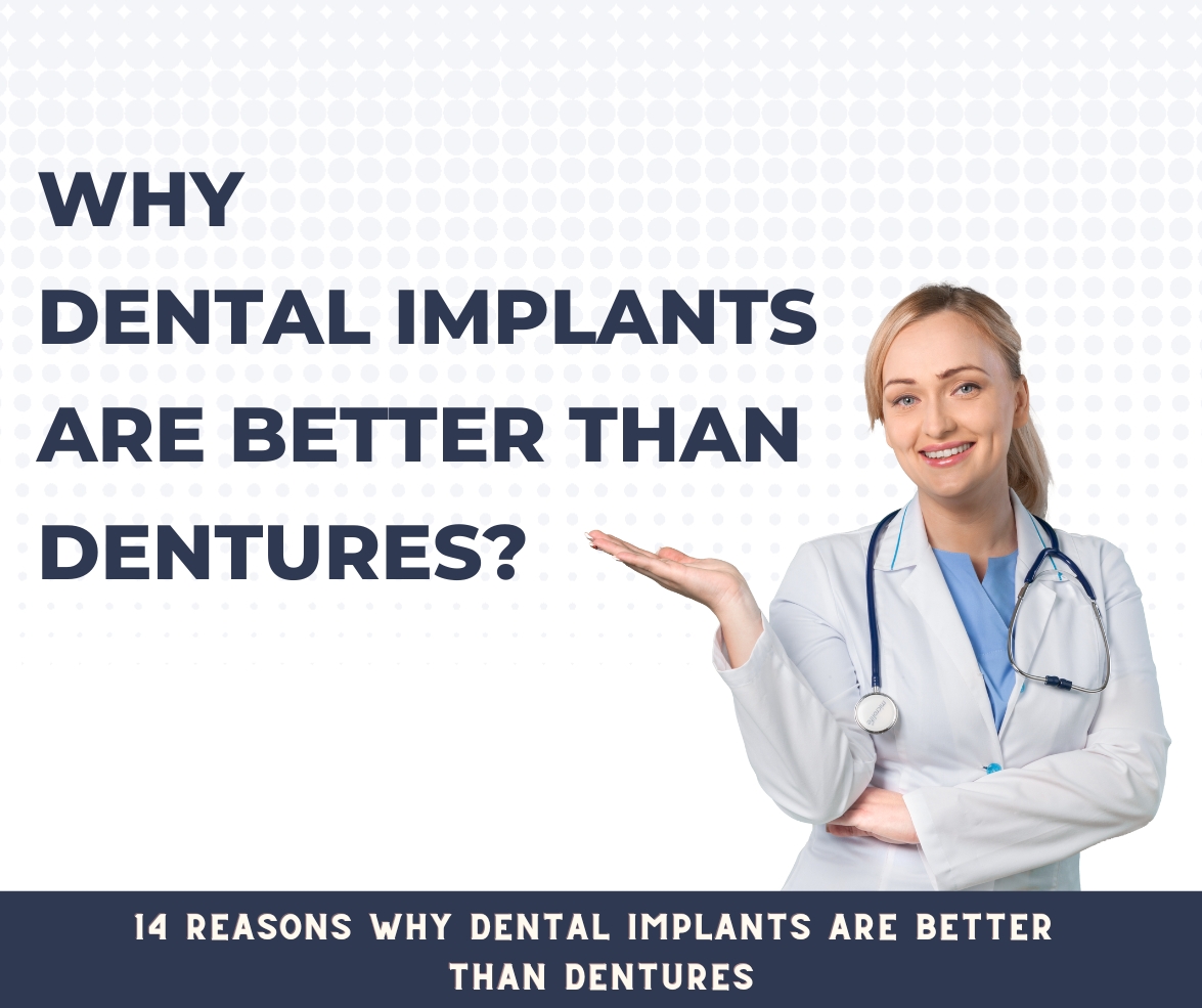 14 reasons why dental implants are better than dentures
