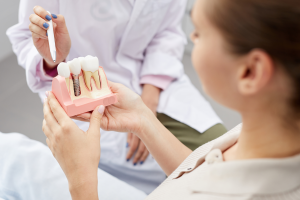 Dental Implants Sherman Oaks