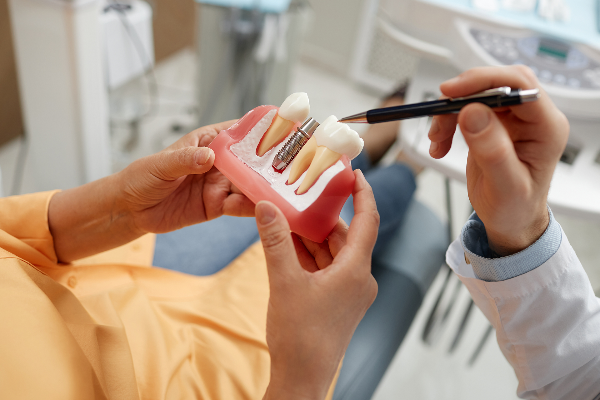 12 tips for dental implants