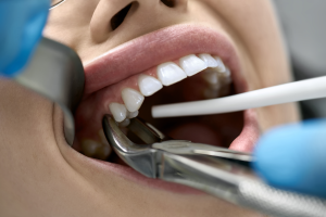 Sherman Oaks Dentist