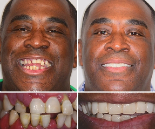 Before-and-After-photo-Derrik-300x239