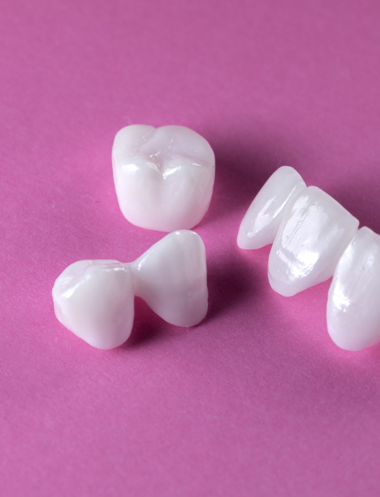 Zircon dentures on a pink background - Ceramic veneers - lumineers